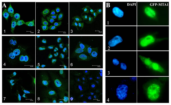 Subcellular localization of MTA1 in cell lines detected through IF (A) and GFP-tag tracing (B).