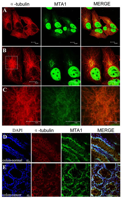 Localization of MTA1 on microtubules in the cytoplasm.