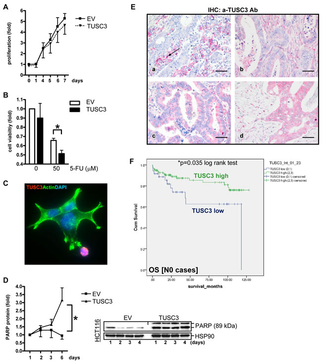 TUSC3 enhances CRC cell death and is associated with prognosis of CRC patients.