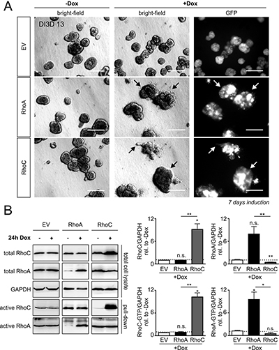 Doxycycline-inducible overexpression of RhoA and RhoC in MCF-10A cells.