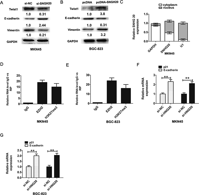 SNHG20 promoted GC cells epithelial-mesenchymal transition (EMT).