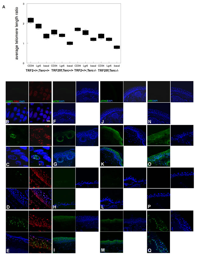 TRF2/Terc double null mutant mice exhibit DNA damage response at short telomeres in epidermis.