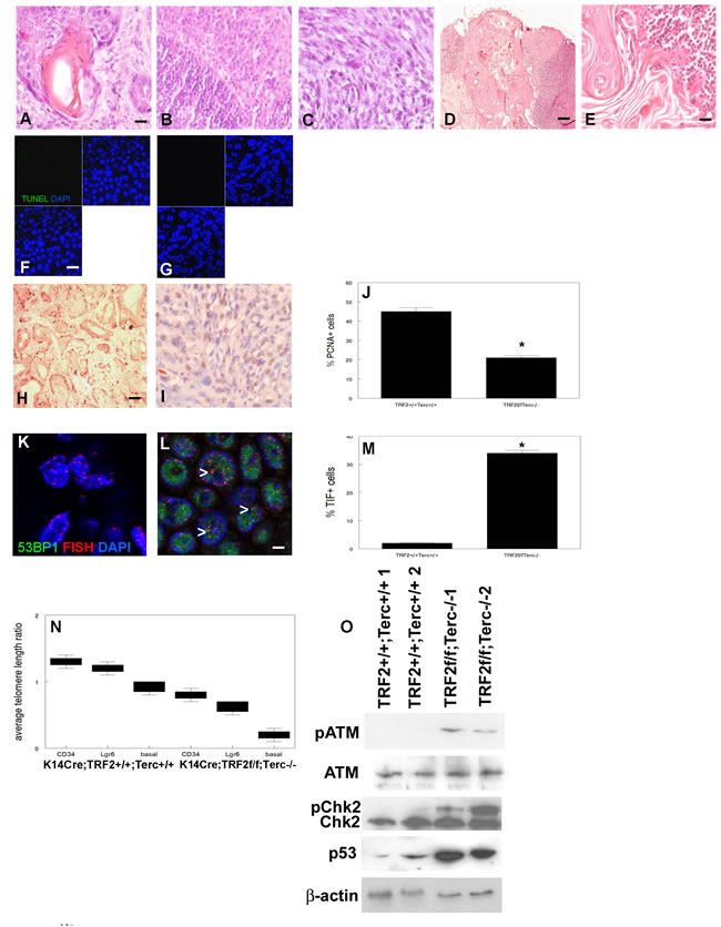 TRF2/Terc double null mutation induces DNA damage response resulting in terminal differentiation of metastatic tumors.