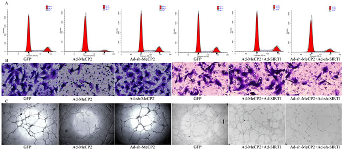 Functional alterations with overexpression or silencing by co-transfection of MeCP2 and SIRT1.