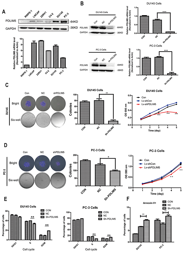 Silencing PDLIM5 inhibited colony formation and proliferation, and induced G2/M phase arrest and apoptosis in DU145 and PC-3 cells.