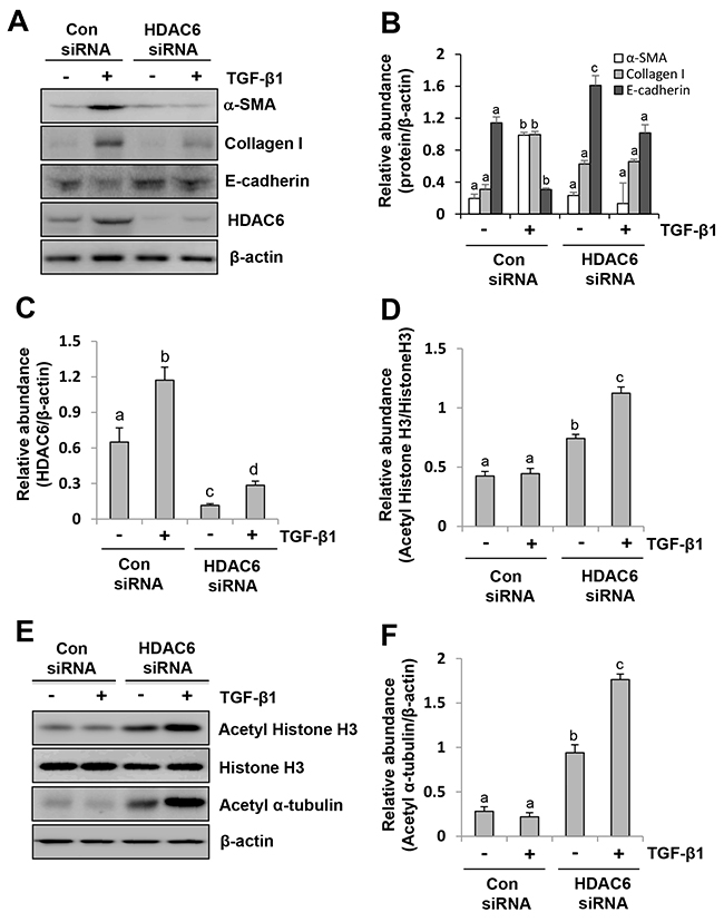 siRNA-mediated silencing of HDAC6 inhibits EMT of peritoneal mesothelial cells.