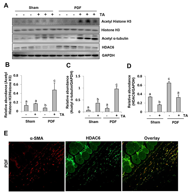 Inhibition of HDAC6 reduces histone H3 acetylation in the peritoneum of mice after exposure to high glucose dialysate.