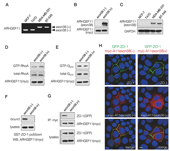 Expression and characterization of ARHGEF11 isoform in breast cancer cells.