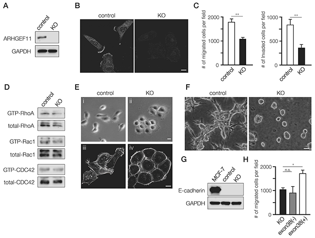 Generation and characterization of A11exon38(+) knockout MDA-MB-231 cells.