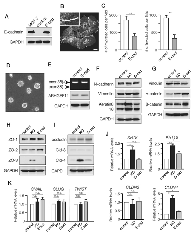 Differential effects of A11exon38(+) depletion and exogenous expression of E-cadherin in MDA-MB-231 cells.