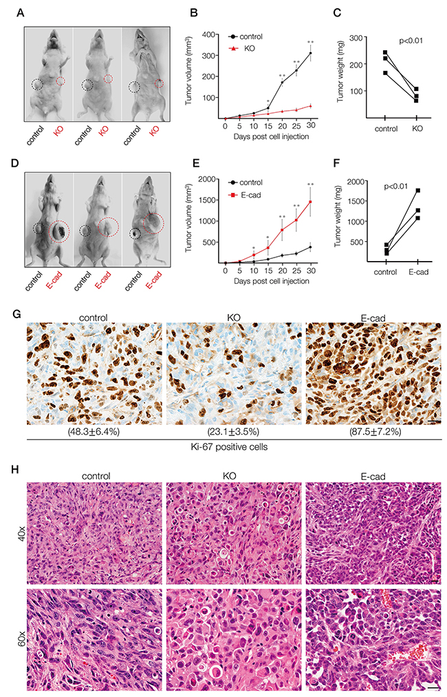 In vivo xenograft tumor formation of MDA-MB-231 cells depleted of A11exon38(+) or exogenously expressed E-cadherin.