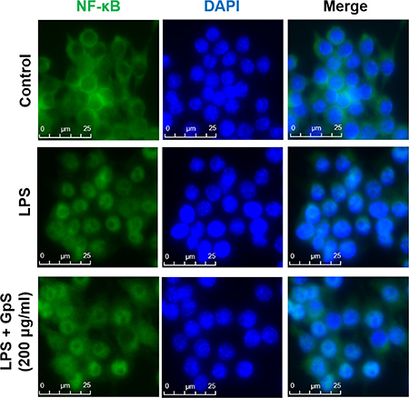 GpS inhibits nuclear translocation of NF-&#x03BA;B/p65 in LPS-induced RAW 264.7 macrophages.