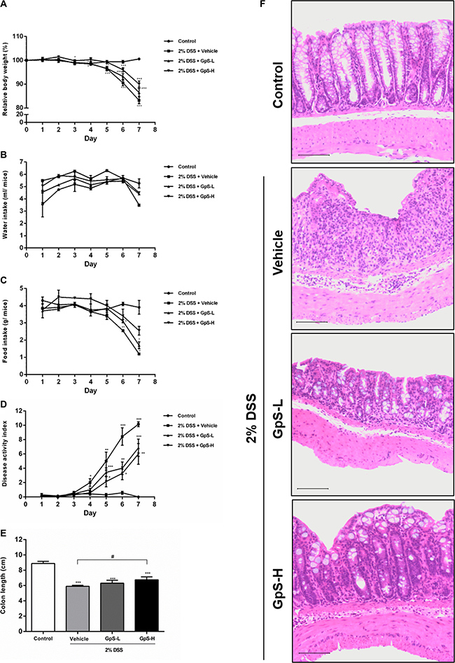 GpS ameliorates the severity of DSS-induced acute colitis in mice.