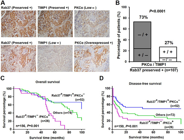 High level of PKC&#x03B1; associated with poor survival in the lung cancer patients with preserved expression of Rab37 and low level of TIMP1.