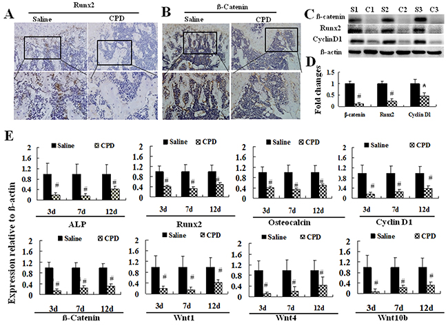 Cyclophosphamide exerted inhibitory effects on the expression of osteoblast differentiation-related factors.
