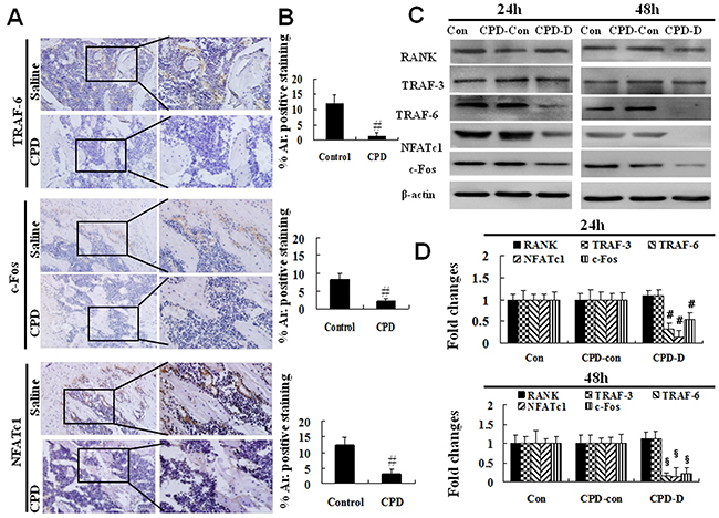 Cyclophosphamide caused the decreased expression of TRAF-6, c-Fos, NFATc1 in mice or in BMMs.