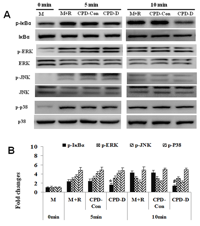 CPD repressed RANKL-activated expressions of NF-&#x03BA;B, while exerting no inhibitory effect on the expressions of ERK, JNK and p38.