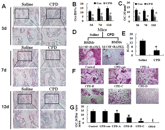 Cyclophosphamide suppressed the activity of TRAP and the capacity of osteoclastogenesis in mice.