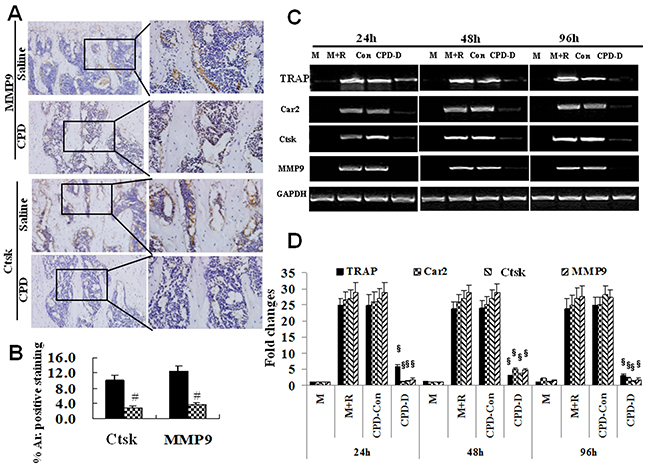 Cyclophosphamide caused the depressed expression of Ctsk and MMP9 in mice and Ctsk, MMP9, TRAP and Car II in BMMs