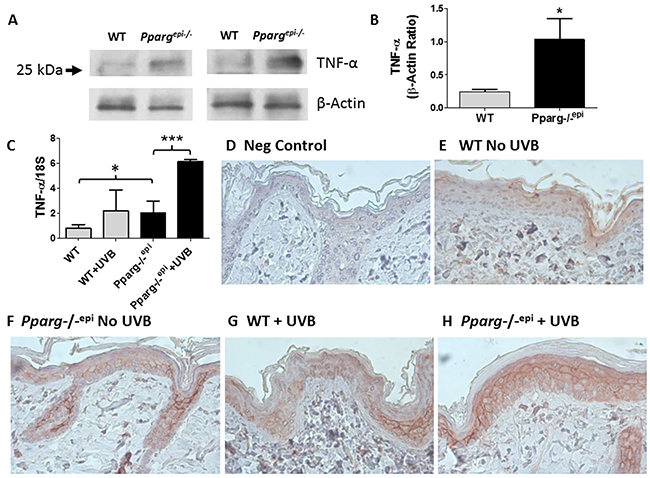 Increased TNF-&#x03B1; consistent with tmTNF-&#x03B1; is observed in Pparg-/-epi mice both prior to and after UVB irradiation.