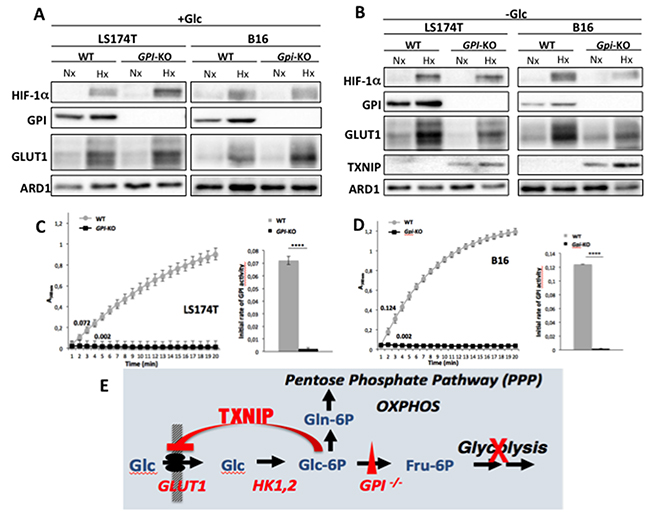 GPI disruption affects GLUT1 and TXNIP expression levels and GPI-enzymatic activities in LS174T and B16 cells.