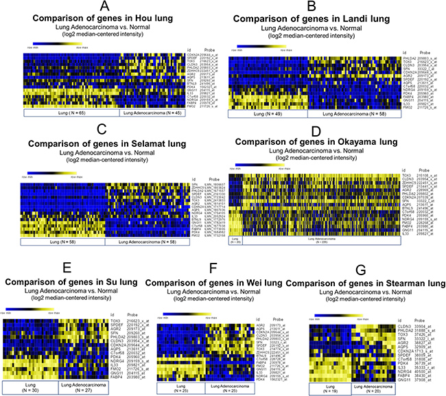 Comparison of differentially expressed genes in clinical lung adenocarcinoma and normal lung tissue by Oncomine database analysis.