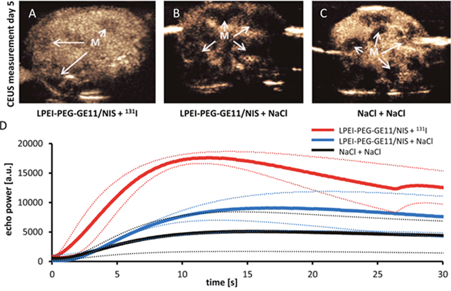 Hepatic contrast enhanced ultrasound (CEUS) measurement.