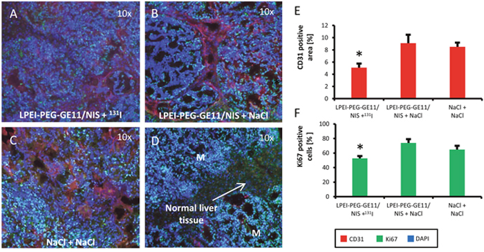 Immunofluorescence staining for tumor cell proliferation and blood vessel density.