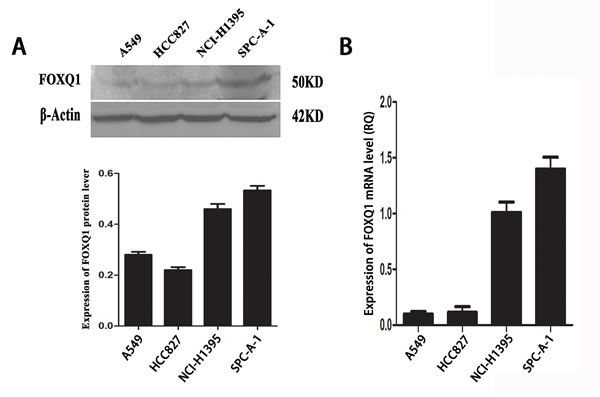 Expression of FoxQ1 protein and mRNA in four non-small cell lung cancer cell lines.