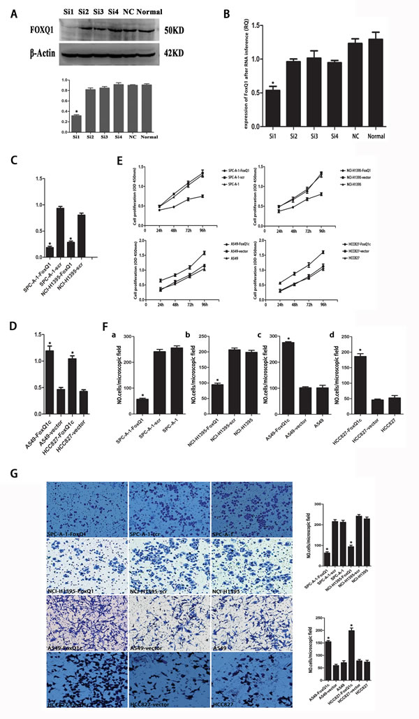 Effect of depleting or enforcing the expression of FoxQ1 on cell proliferation, migration and invasiveness of lung carcinoma cells.