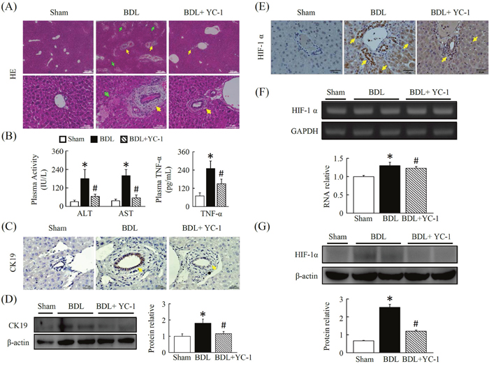 YC-1 attenuated cholestasis-induced liver injury in mice.