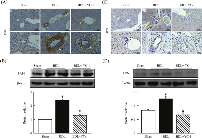 Effects of YC-1 on protein levels of plasminogen activator inhibitor-1 (PAI-1) and osteopontin (OPN) in the BDL mice.