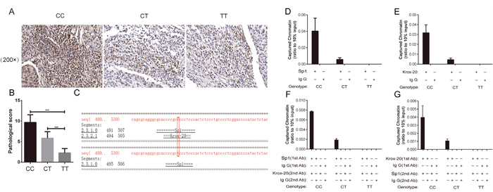XRCC1 rs3213245 CC genotype promoted tumoral XRCC1 expression in patients.