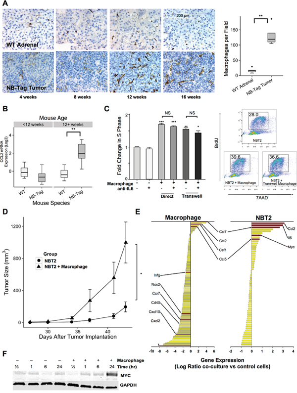 TAM infiltration in NB-Tag tumors is associated with tumor proliferation and induction of MYC expression.