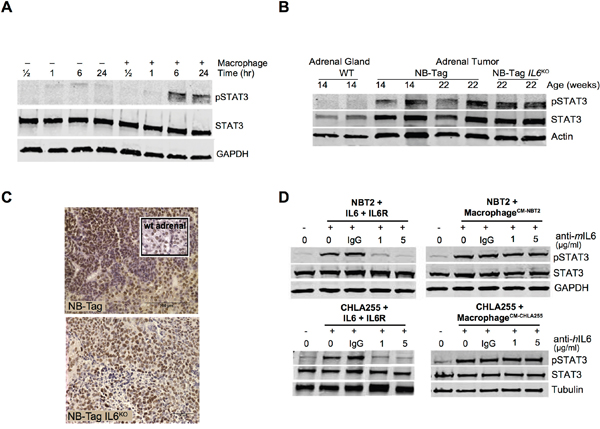 STAT3 activation in human and murine NBL cells by macrophages does not require IL-6.