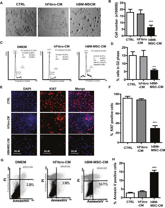 hBM-MSC-CM exhibits anti-proliferation and pro-apoptosis effect on SSCs.