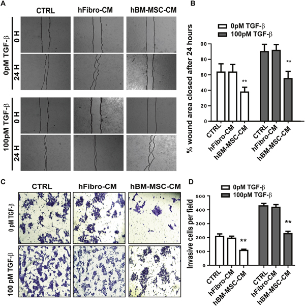 hBM-MSC-CM inhibits the migration and invasiveness of SCCs.