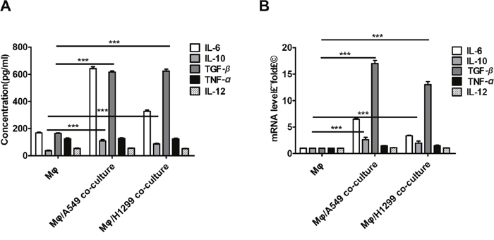 Lung cancer cells induced M2 polarization in macrophages.