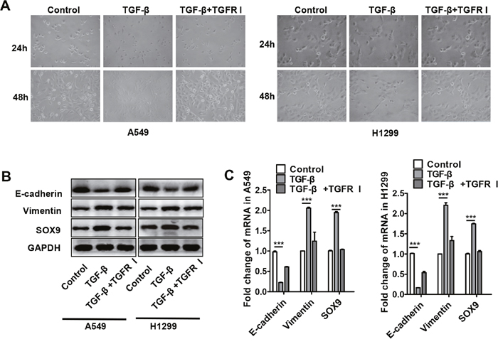 TGF-&#x03B2; increased SOX9 expression and induced transformation into an EMT-like phenotype in lung cancer cells.
