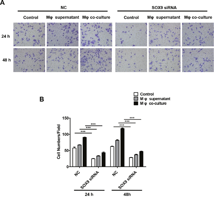 Macrophages promote SOX9-dependent invasion in lung cancer cells.