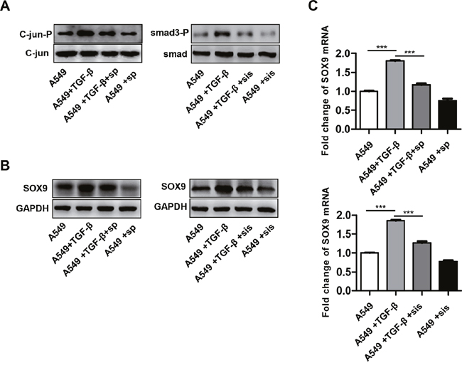 TGF-&#x03B2; promotes SOX9 expression via the C-Jun and SMAD3 signaling pathway.
