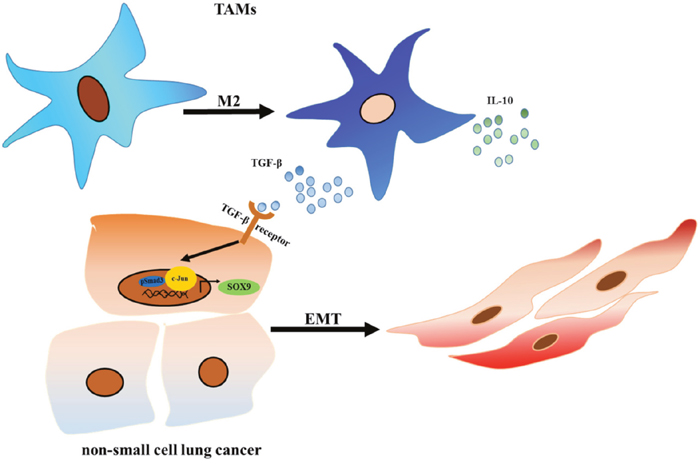 TAMs promote tumor metastasis via the TGF-&#x03B2;/SOX9 axis in non-small cell lung cancer.