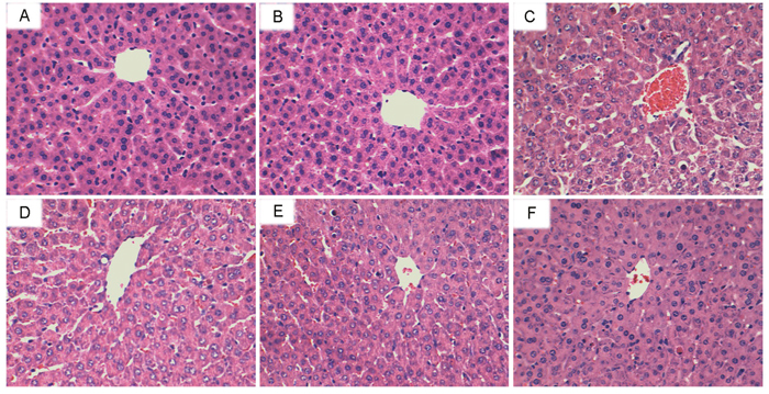 Effects of shikonin on histopathological changes in liver tissues.