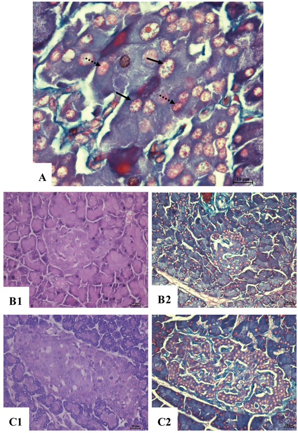 Histopathological changes of pancreatic islet tissue.