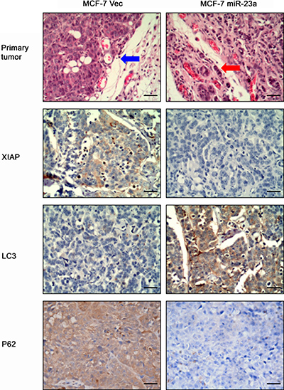 Effects of forced expression miR-23a on regulation of MCF-7 xenograft in nude mice.