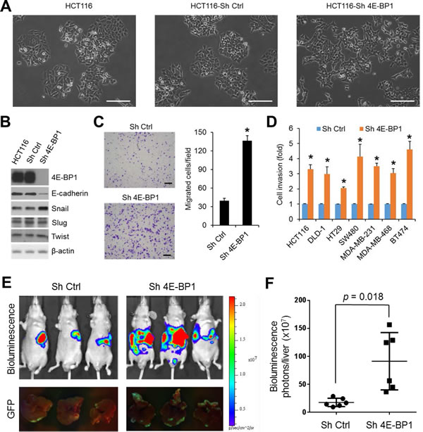 Silencing of 4E-BP1 induces EMT, upregulates Snail expression, and enhances cancer cell migration, invasion and metastasis.
