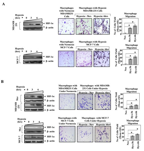 Fig 1: Hypoxia Primed Breast Cancer Cells Chemoattract Macrophages.