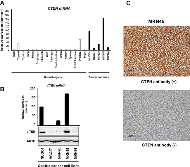 Expression profiles of CTEN in GC cell lines.