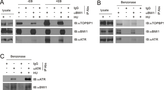 BMI1 associates with TOPBP1.