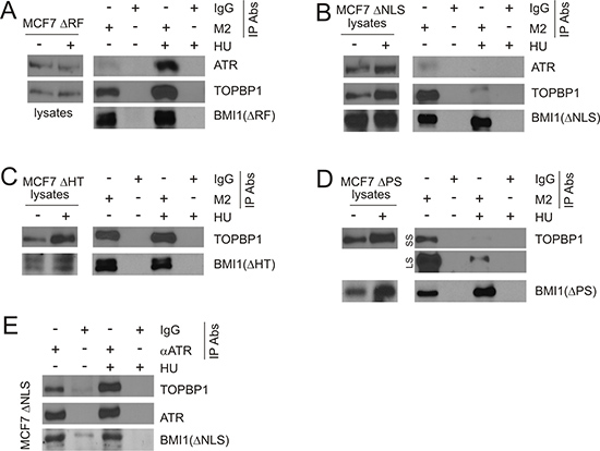 Characterization of BMI1 association with TOPBP1 and ATR.